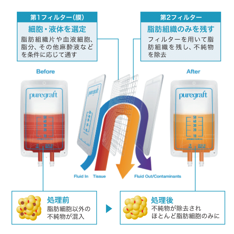 ピュアグラフト